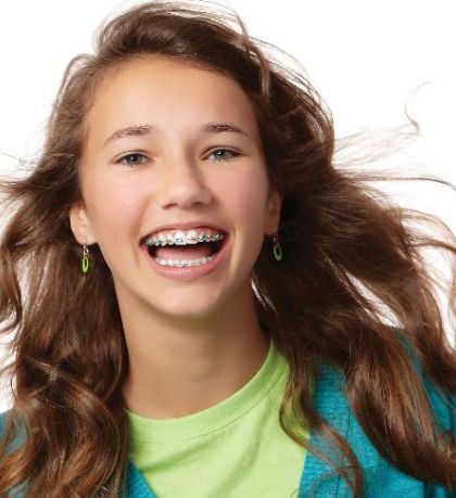 Happy young woman with straight teeth and healthy smile in Woodbury, MN.