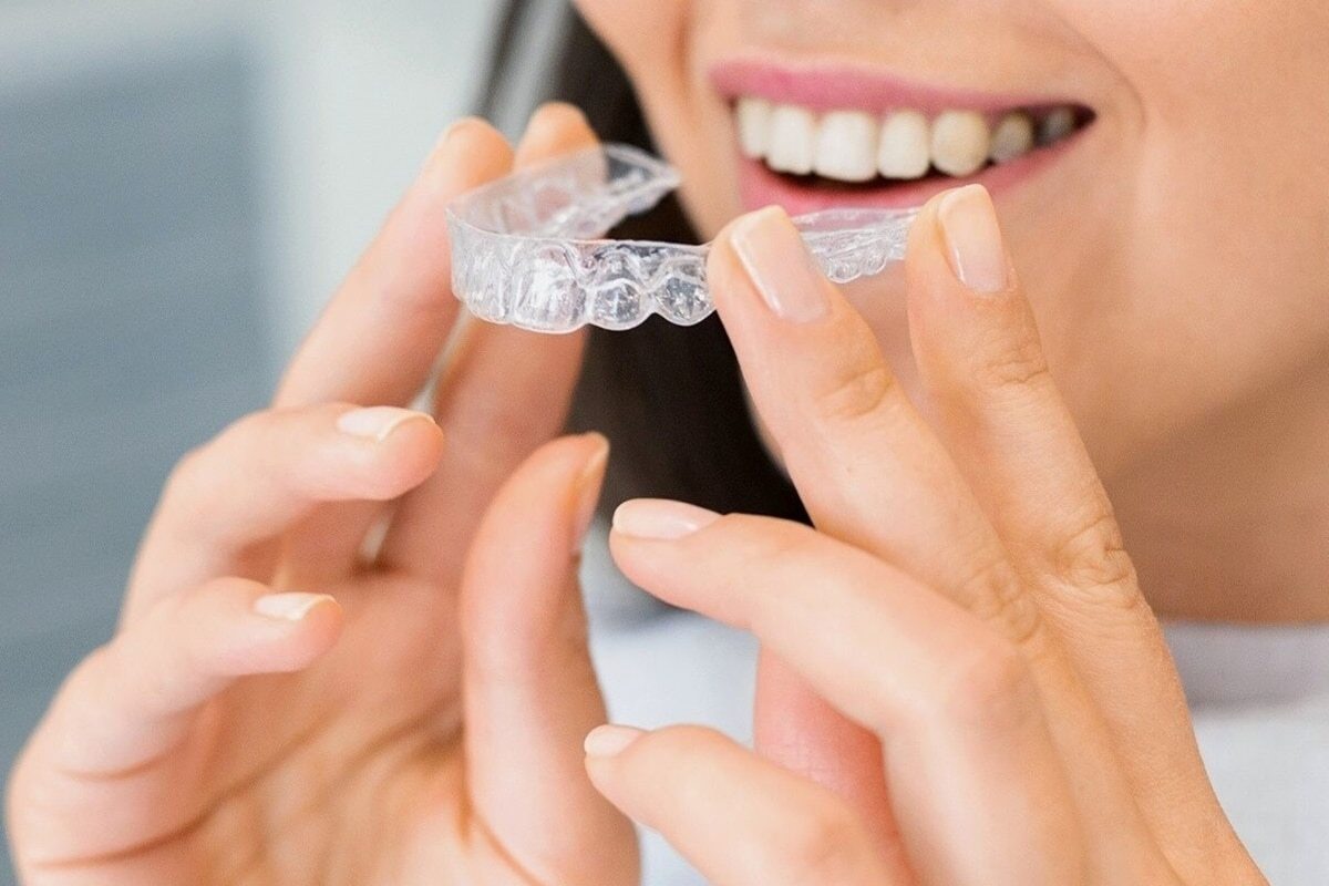 Woman inserting a clear Invisalign aligner tray into her mouth, demonstrating proper placement of the orthodontic treatment.