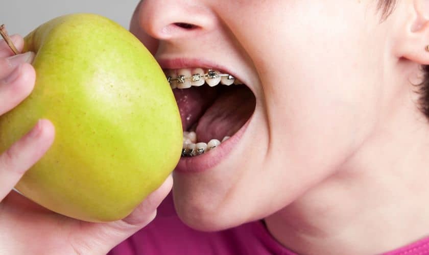 Young athlete with braces biting into a green apple for healthy nutrition.