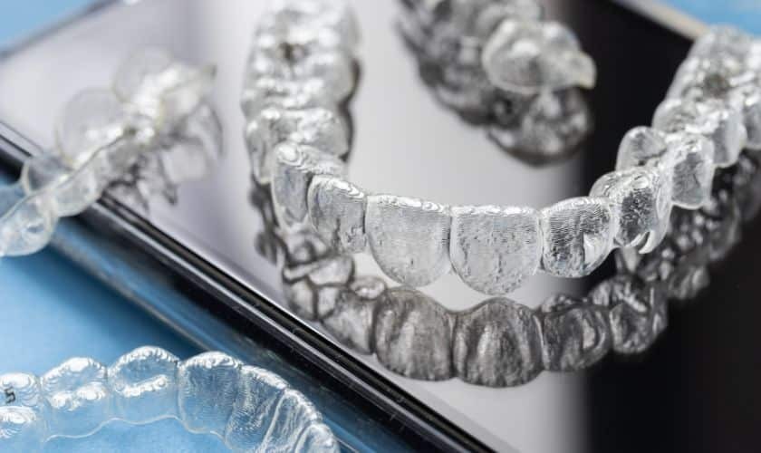 Clear Invisalign aligners displayed next to a dental scan model showing tooth positioning.