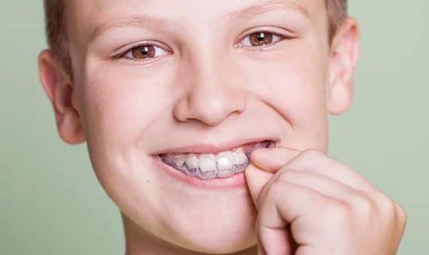 Young patient displaying clear aligners and a confident smile.