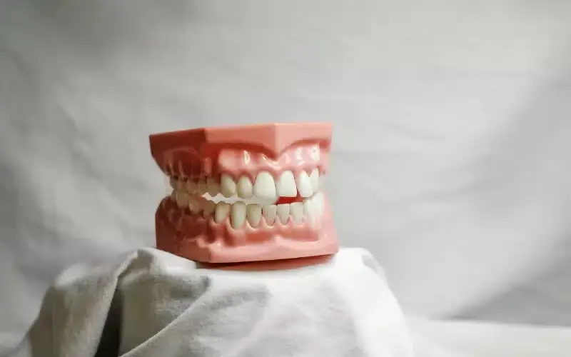 Dental model showing teeth alignment with pink gum tissue and white teeth on display stand.