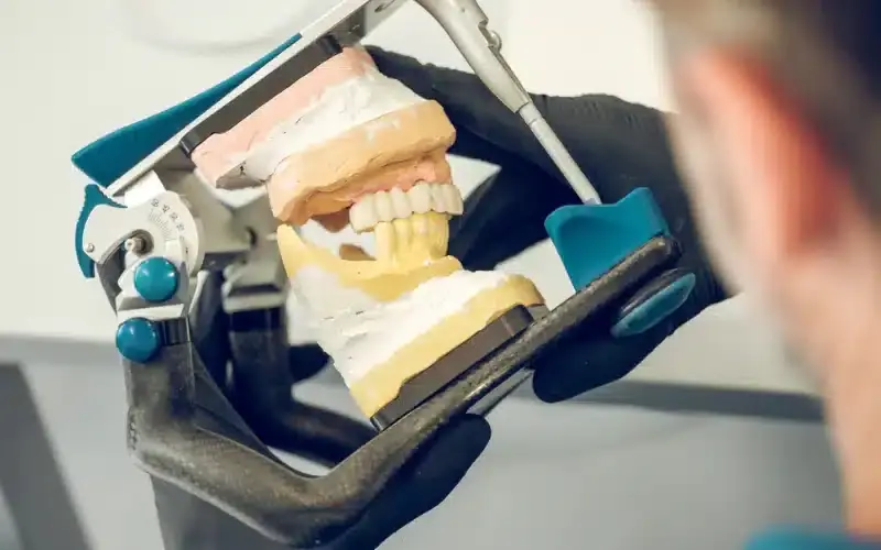 Dental model showing teeth positioning and bite alignment used in orthodontic treatment planning.