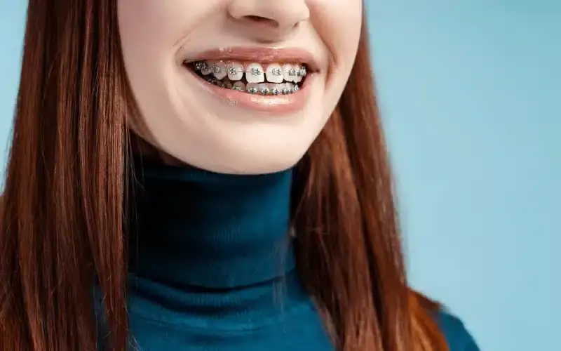 Young woman with red hair smiling, showing straight teeth with braces in place.