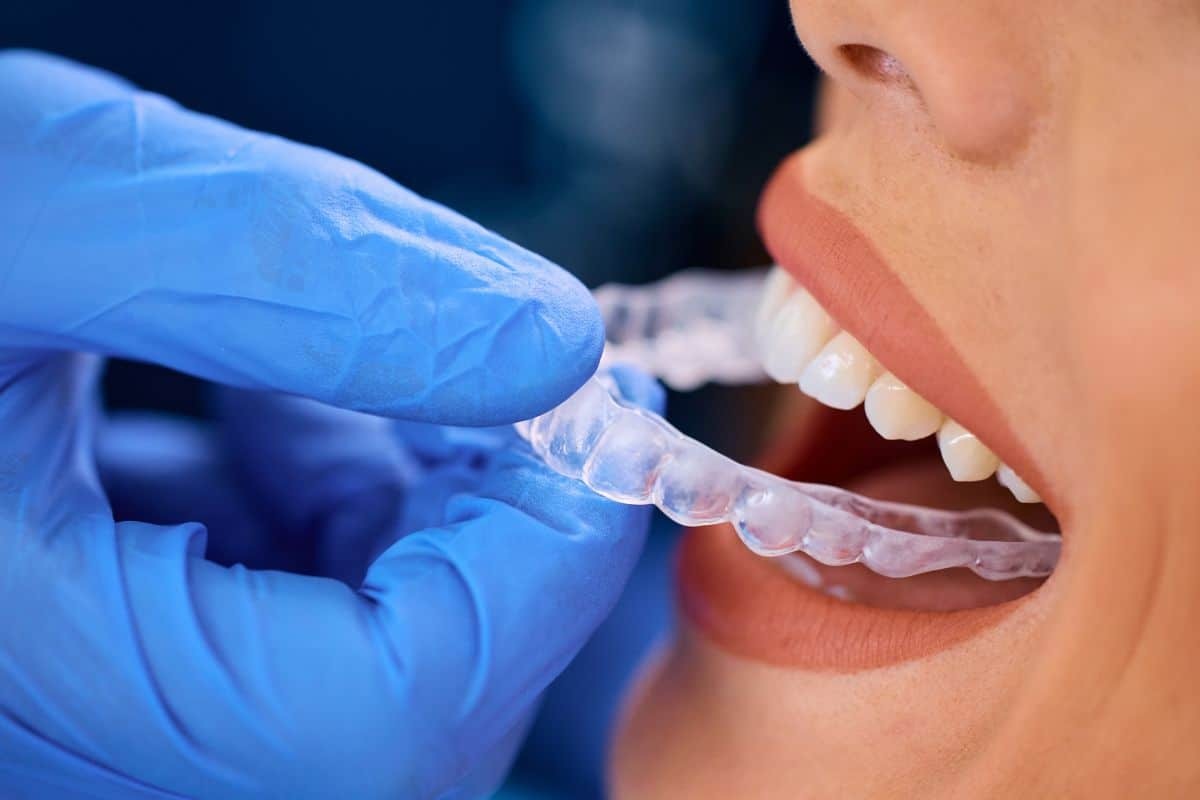 Dentist holding clear Invisalign aligner tray near patient's open mouth showing teeth.