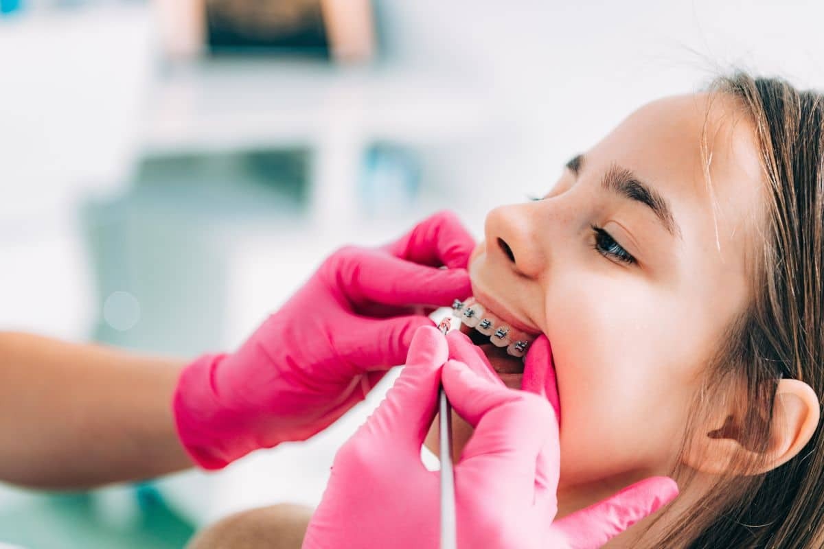 Orthodontist adjusting metal braces on young patient's teeth during dental treatment.