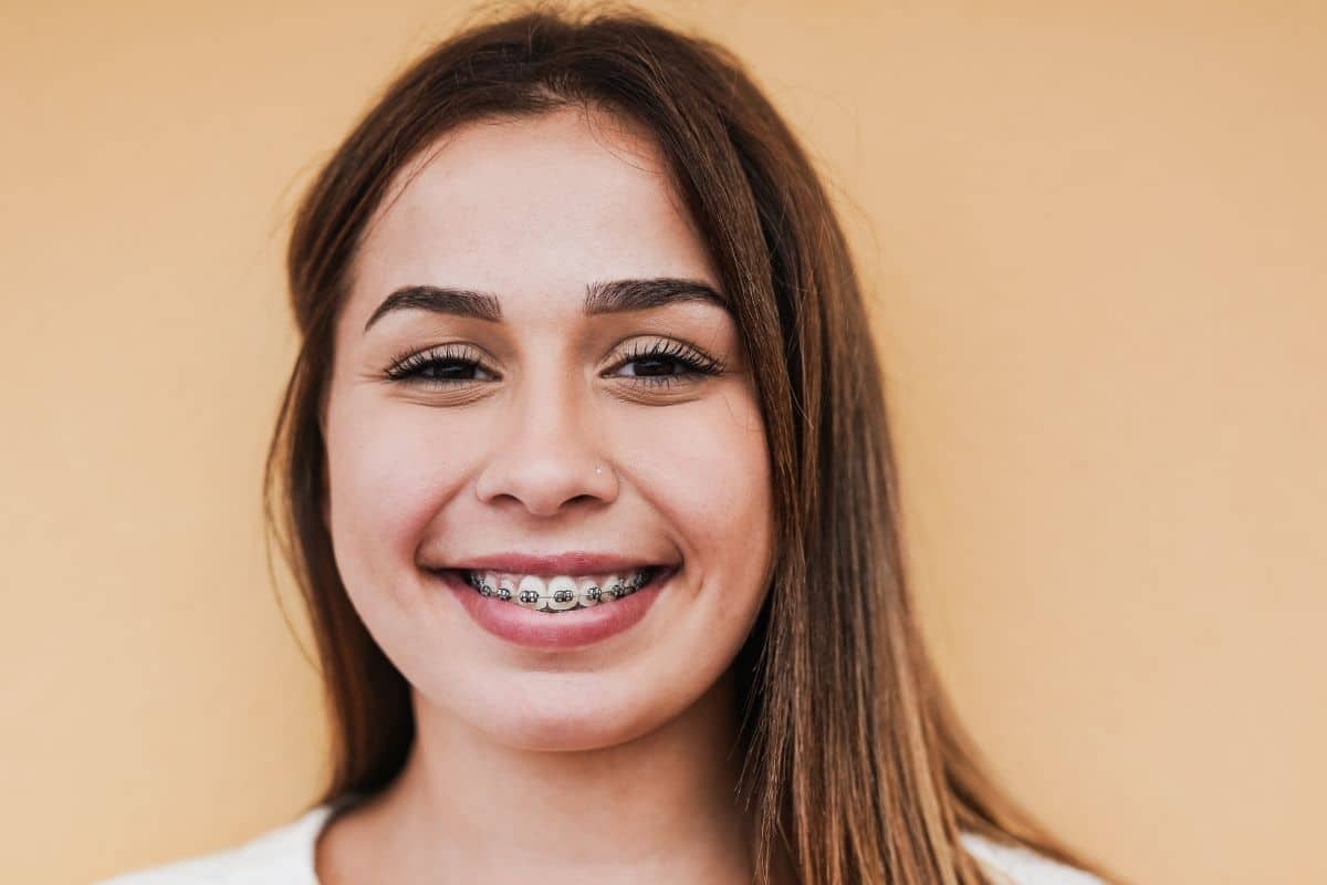 Young woman smiling with metal braces showing successful orthodontic treatment results.