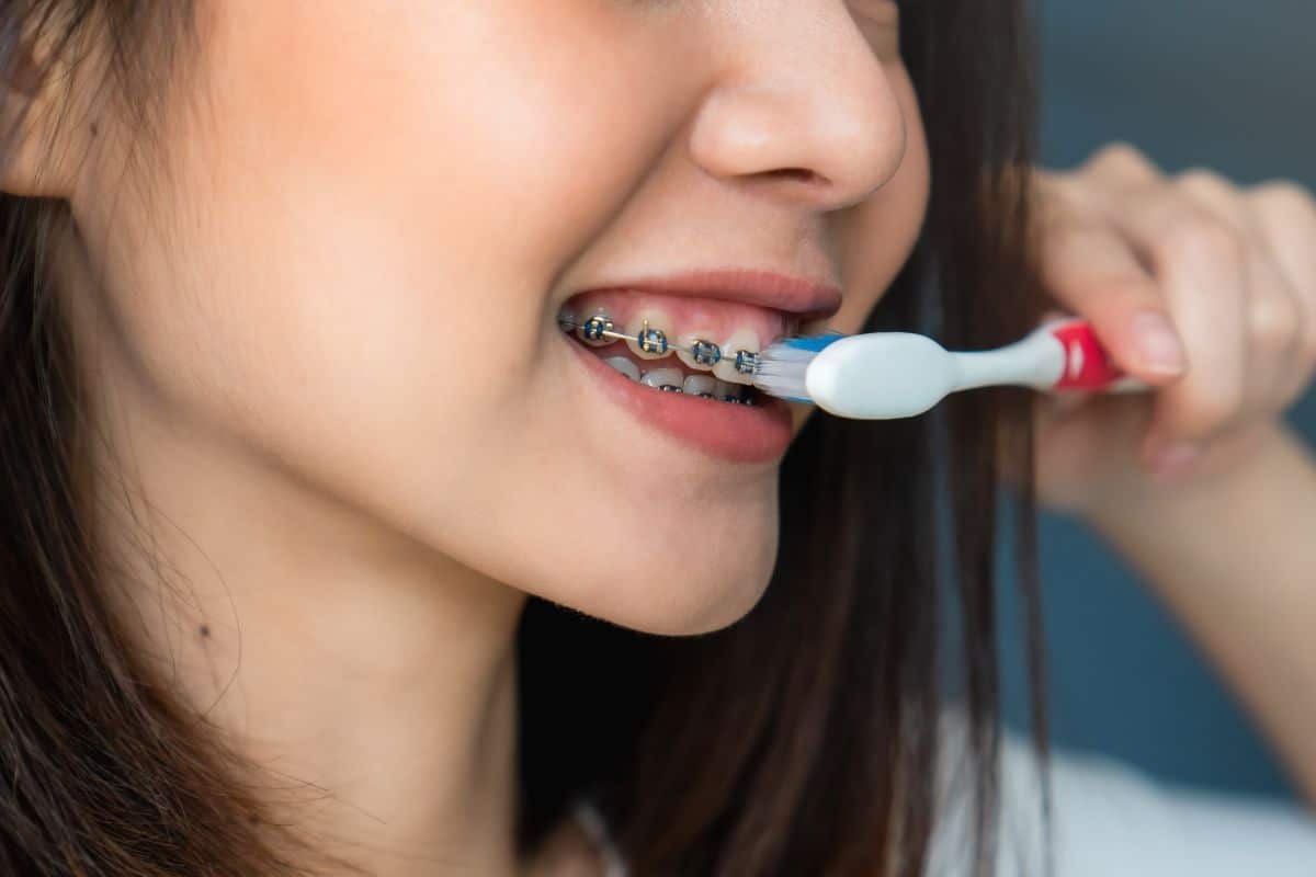 Woman brushing teeth with braces using a specialized orthodontic toothbrush.