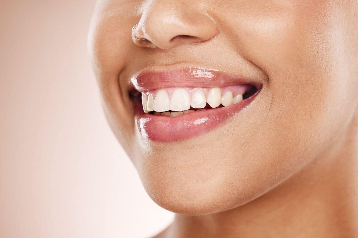 Woman smiling showing white healthy teeth after orthodontic treatment.