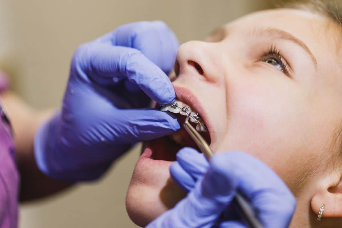 Pediatric patient receiving interceptive orthodontic treatment with metal braces during dental examination.