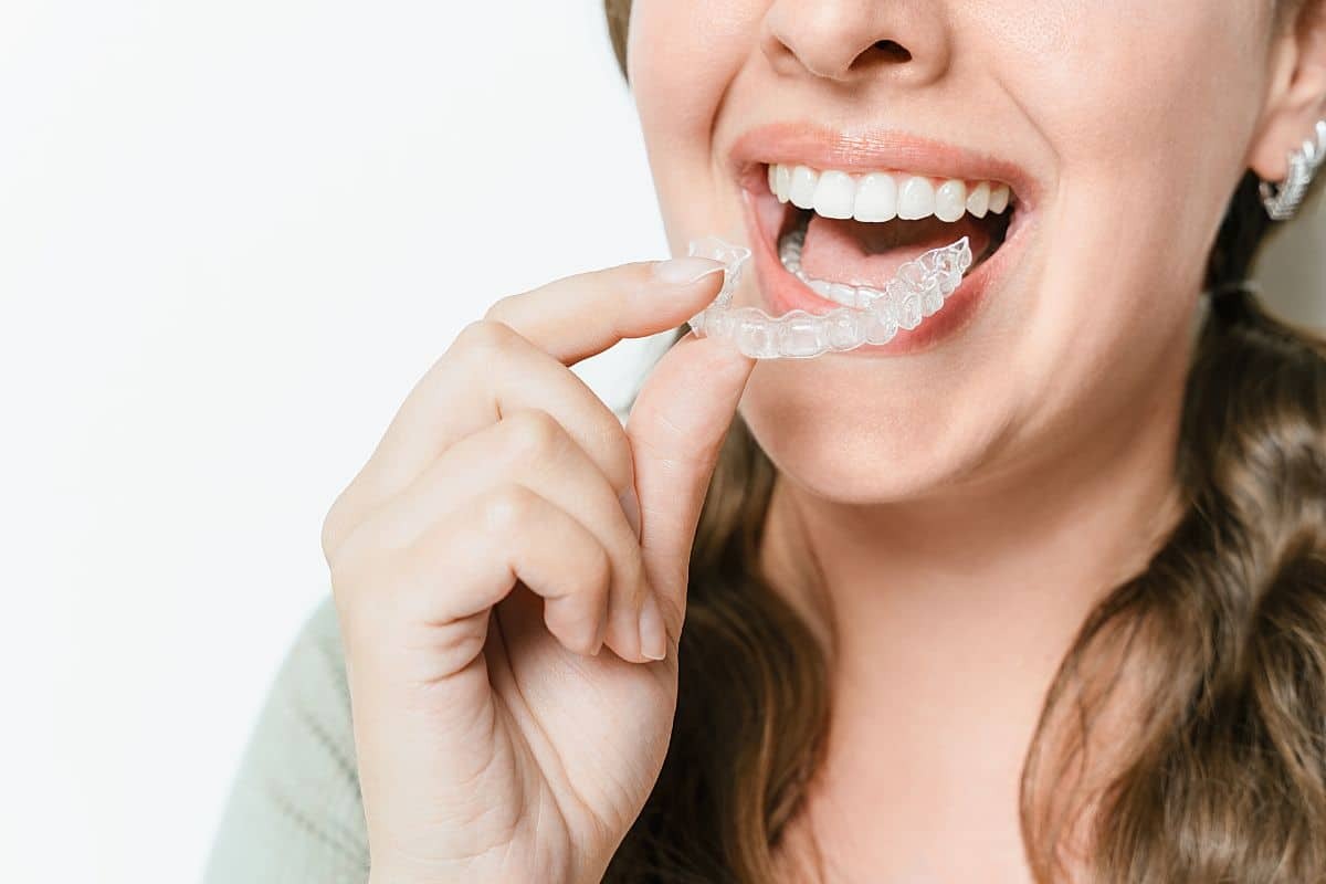 Woman inserting clear Invisalign aligner tray into her mouth during orthodontic treatment.