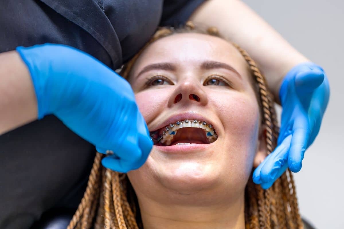 Dental professional examining patient's braces during orthodontic appointment.