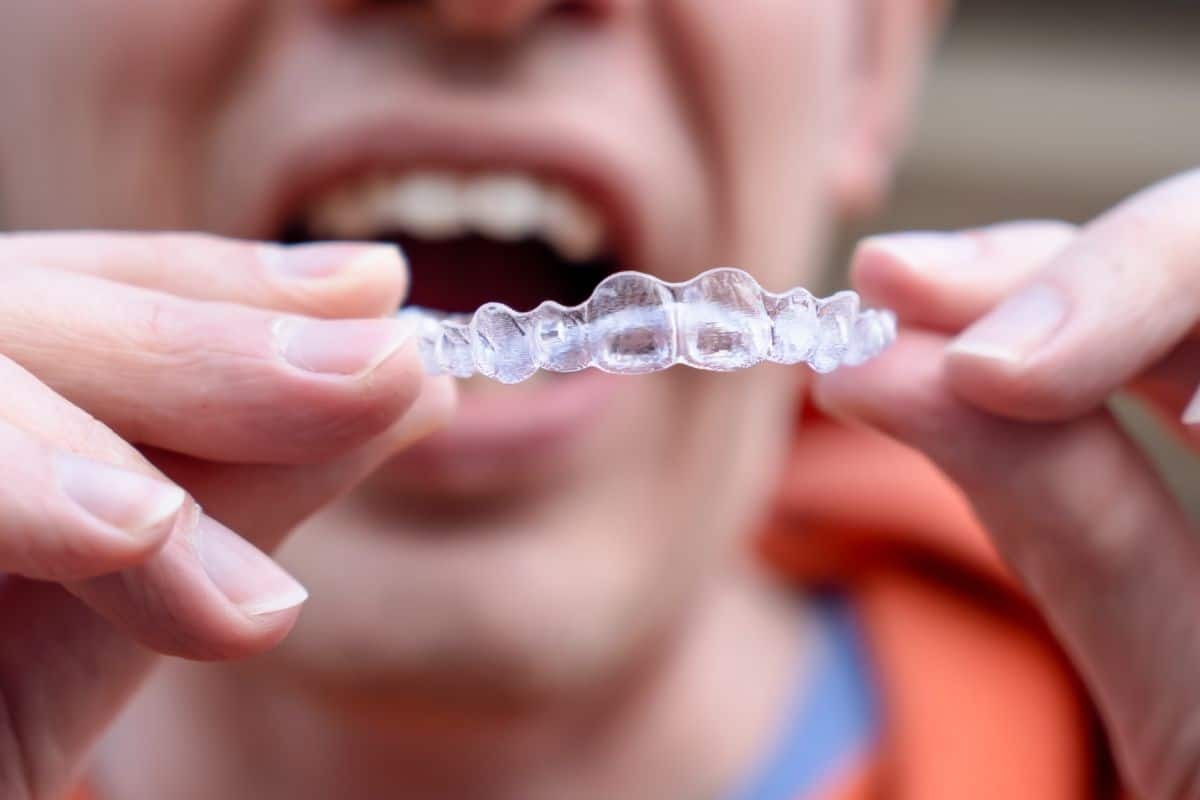 Close-up of a clear Invisalign aligner held in hands near smiling patient's mouth.