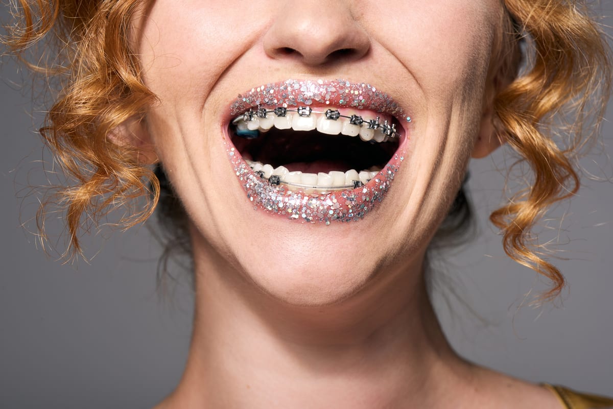 Braces For Adults in Roseville