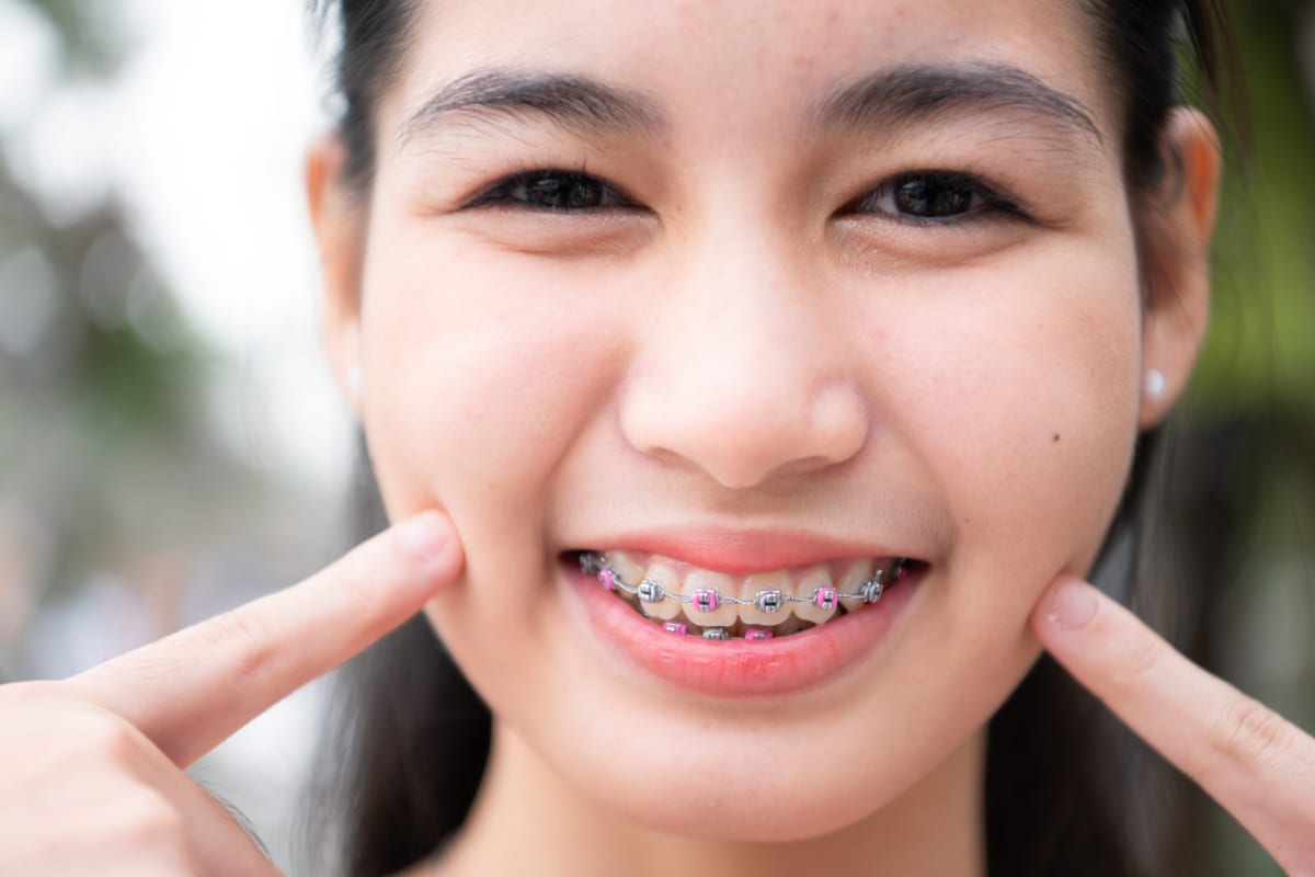 Orthodontics in Roseville