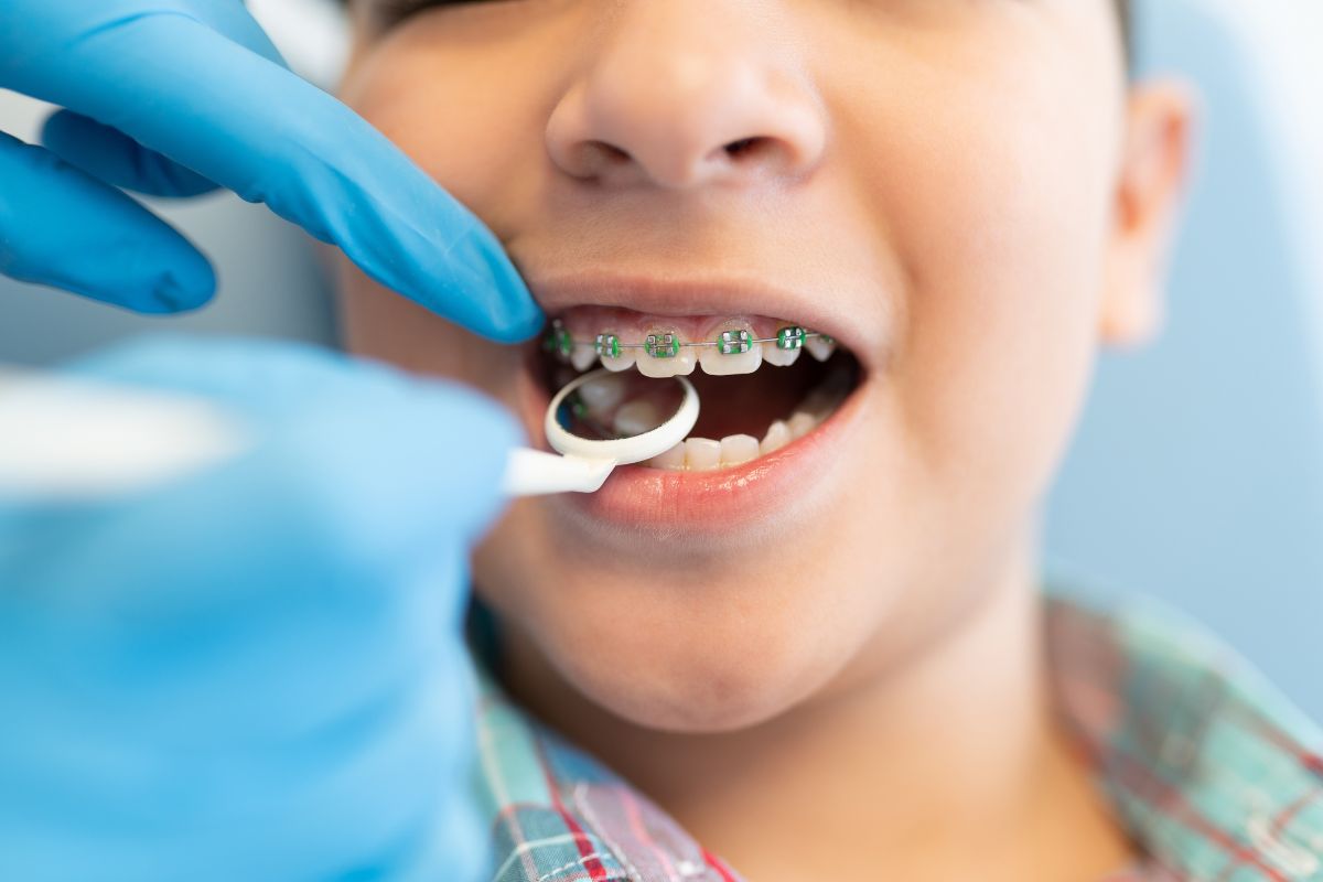 orthodontic treatment